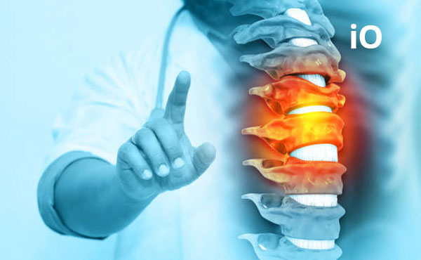Omurilik Kanal Darlığı (Spinal Stenoz): Ameliyat Gerekli mi, Ne Zaman Gerekir?